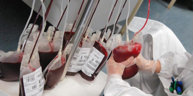 Morte di pensionata per trasfusione errata: procuratore richiede arresto del cardiochirurgo Sorrentino