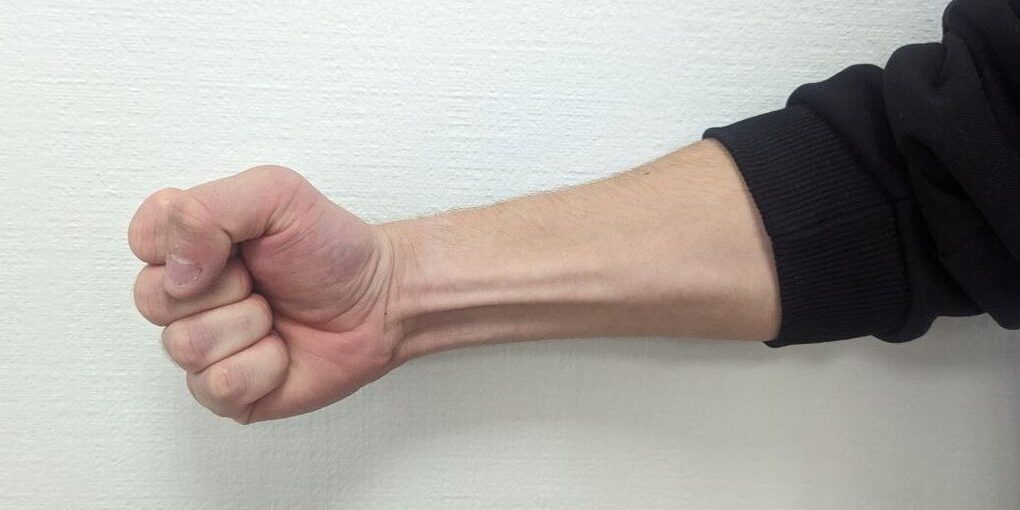 В Калининграде задержали 18-летнего жителя, избившего подростка