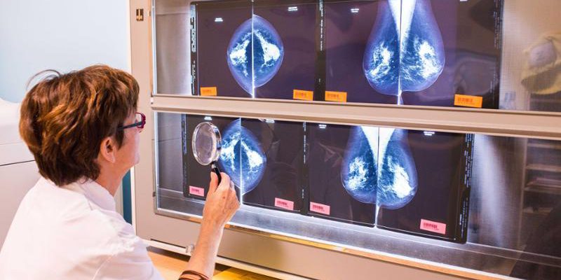 Piemonte rimborsa fino a 400 euro per il tatuaggio del seno dopo intervento contro il tumore