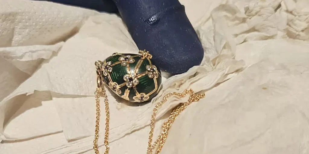 Persona ingoia collana da 19.500 dollari recuperata senza intervento medico