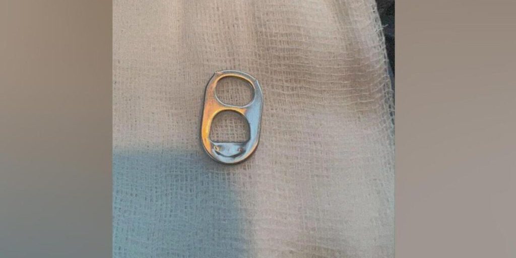 Bambino di un anno e mezzo salvato dopo aver inghiottito una chiave di lattina: l'importanza della vigilanza e della prevenzione nella sicurezza dei più piccoli