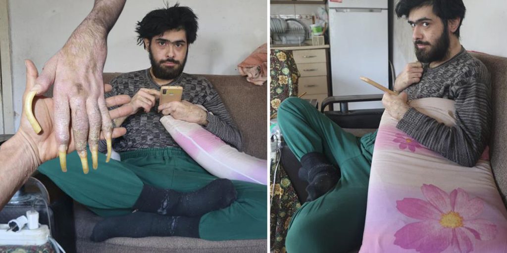 6 Şubat depremi hayatını kararttı! 3 yıldır evden çıkmıyor, banyo yapmıyor, tırnak kesmiyor...