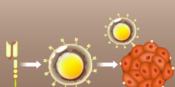 Linfomi: estesa copertura CAR‑T per pazienti senza risposta alla prima terapia