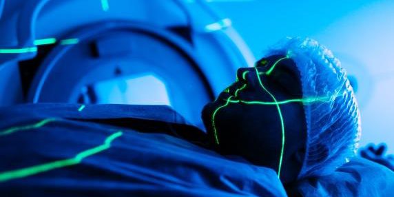 Radioterapia: 70 % dei pazienti non riportano effetti collaterali significativi, secondo uno studio