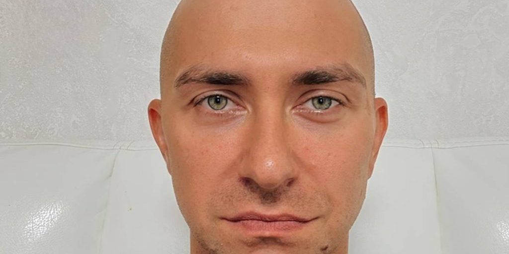 Едва не погибшему российскому рэперу удалили опухоль мозга