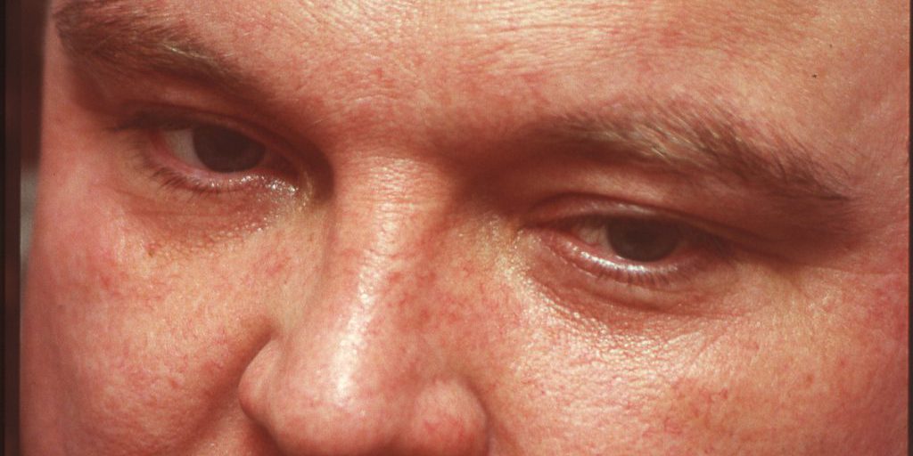 La Libertà di Espressione in Discussione: il Caso delle Canzoni di Mikhail Krug in Russia