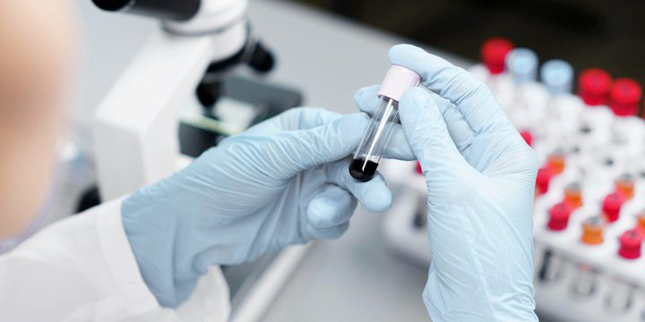 В России разработан экспресс-тест для диагностики сальмонеллеза