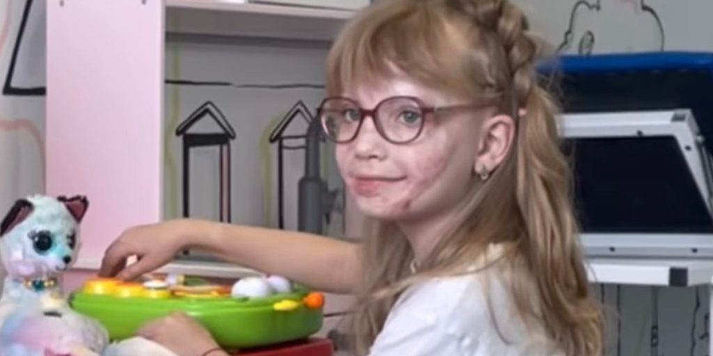 Seven-year-old, injured in 2023 helicopter crash in Brovary, has undergone dozens of surgeries with more to come