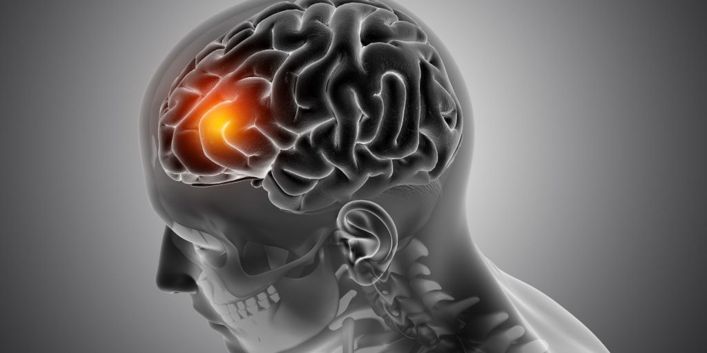 Morte improvvisa dell'attrice Isabelle Tate a 23 anni: una storia di coraggio e talento stroncata dalla malattia di Charcot-Marie-Tooth

La giovane attrice Isabelle Tate muore a 23 anni
La giovane attrice Isabelle Tate, nota per il suo ruolo nella serie "9-1-1: Nashville", è morta all'età di 23 anni la scorsa domenica, 19, pochi giorni dopo aver registrato un episodio per la serie derivata da "9-1-1". La morte è stata confermata giovedì 23 dal suo manager, che ha informato il portale TMZ che Isabelle "è morta pacificamente mentre dormiva". Il funerale era previsto per venerdì 24.

Approfondimento
Isabelle era stata diagnosticata con la malattia di Charcot-Marie-Tooth, una condizione neuromuscolare rara che provoca debolezza negli arti e perdita di sensibilità. A causa della malattia, l'attrice si spostava con l'aiuto di una sedia a rotelle. Nonostante le limitazioni fisiche, manteneva una routine attiva e ispiratrice.

Possibili Conseguenze
La morte di Isabelle Tate ha suscitato grande tristezza tra i fan e i colleghi della serie "9-1-1: Nashville". La sua scomparsa ha anche sollevato interrogativi sulla gestione della sua condizione medica e sulle possibili conseguenze della malattia di Charcot-Marie-Tooth.

Opinione
Secondo l'obituario pubblicato dall'Agencia McCray, che rappresentava l'artista, Isabelle era "piena di energia, una combattente, che non si scusava mai per la sua disabilità rispetto agli altri". Il testo ha anche sottolineato il talento musicale dell'attrice, che "aveva una forte inclinazione per la musica, spesso passando ore a comporre e registrare con gli amici, e aveva anche pubblicato alcune delle sue canzoni".

Analisi Critica dei Fatti
La morte di Isabelle Tate è un evento tragico che ha colpito la comunità cinematografica e televisiva. La sua storia è un esempio di come la determinazione e la passione possano superare le limitazioni fisiche e ispirare gli altri.

Relazioni con altri fatti
La serie "9-1-1: Nashville" è una delle più recenti produzioni televisive in cui Isabelle Tate ha recitato. La serie ha debuttato sulla ABC il 9 ottobre 2025 e ha ricevuto grande attenzione da parte del pubblico e della critica.

Contesto storico
La malattia di Charcot-Marie-Tooth è una condizione neuromuscolare rara che colpisce circa 1 persona su 2.500. La malattia è caratterizzata da debolezza e atrofia muscolare, che può portare a difficoltà di mobilità e di sensibilità.

Fonti
Il sito della fonte rss è TMZ. Il link diretto all'articolo fonte è https://www.tmz.com/2025/11/23/isabelle-tate-dead-at-23/.