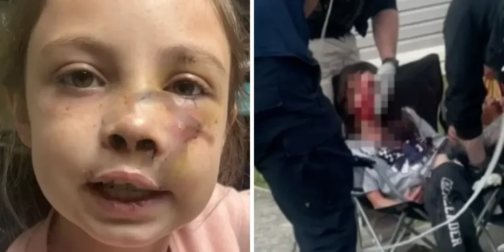 Alabama: attacco di cane lascia bambina gravemente ferita