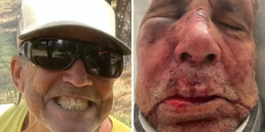 71enne Jeff Zimmerman aggredito da ciclista in Arizona mentre passeggiava con il cane