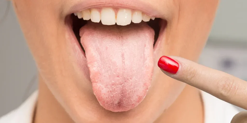 AI che legge la lingua: diagnosi precoce di diabete e cancro allo stomaco