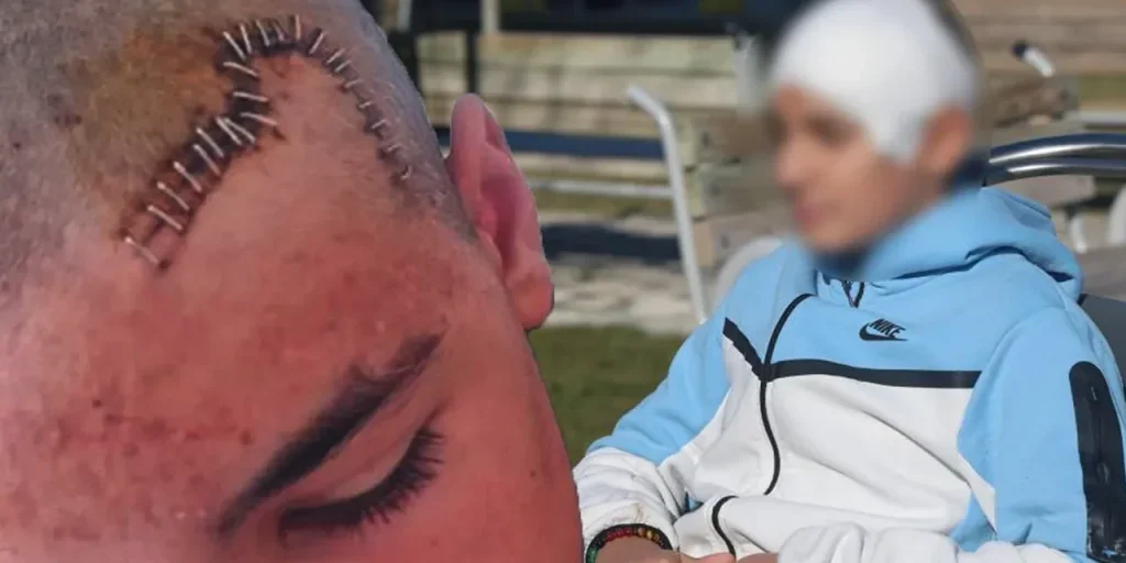 Ragazzo di 13 anni colpisce compagno con pietra a Konya: arresto, rilascio e nuovo arresto dopo post sui social