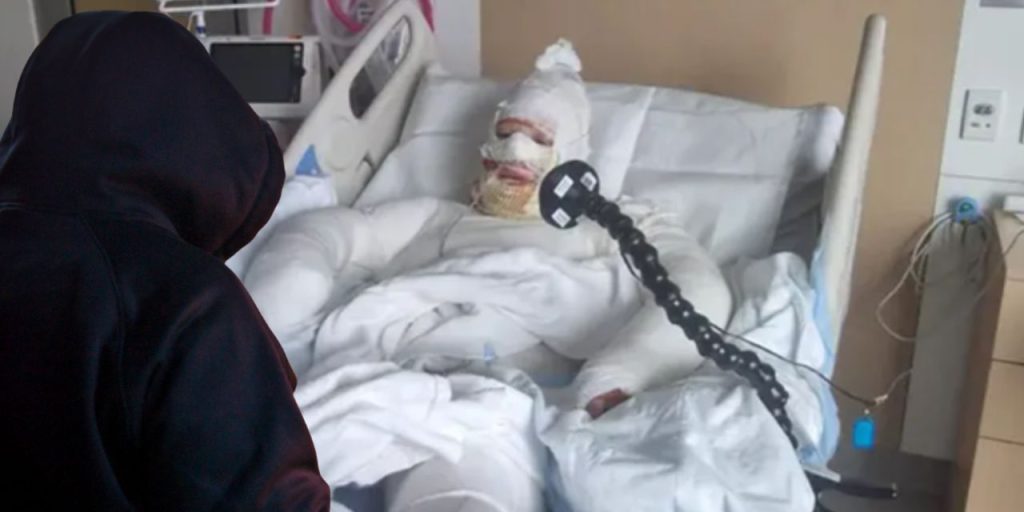 Attacco con Molotov in Australia: donna madre di due bambini ustionata gravemente in un parcheggio di Mandurah