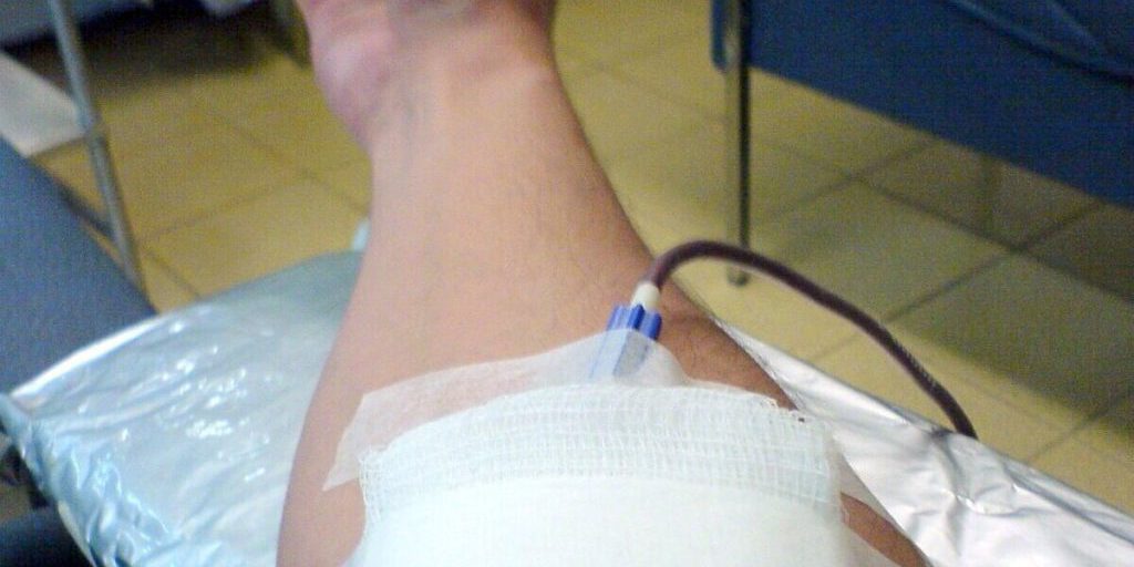 Nuovi Regolamenti per la Sicurezza del Sangue Donato in Russia: Miglioramento della Qualità e Riduzione dei Rischi per i Pazienti