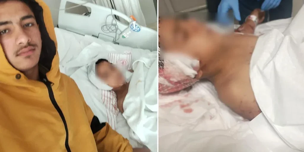 Bambino di otto anni attaccato da cani randagi a Ankara: in ospedale con lesioni gravi