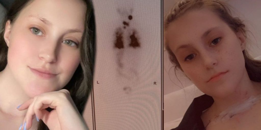 Cildindeki döküntüyle gitti… Doktorun dikkati sayesinde 5 yıllık gizli hastalığı ortaya çıktı