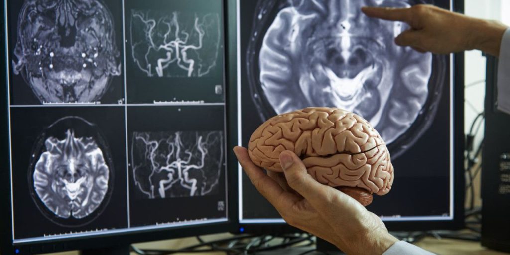 Parlare più di una lingua può rallentare l'invecchiamento cerebrale e ridurre il rischio di declino cognitivo