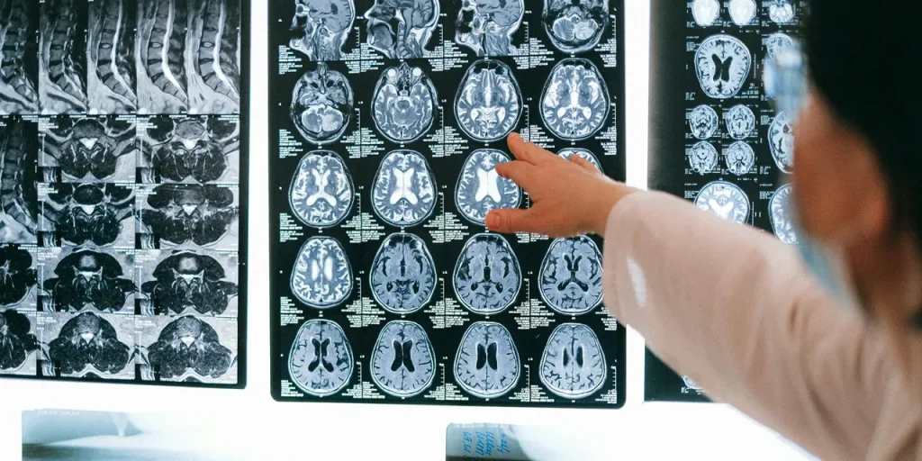 Mi servirebbe il testo completo (o almeno una parte significativa) dell’articolo “Beyninizi 8 yaş gençleştirecek dört alışkanlık: Bilim insanları açıkladı!” per poter creare un titolo informativo in italiano.