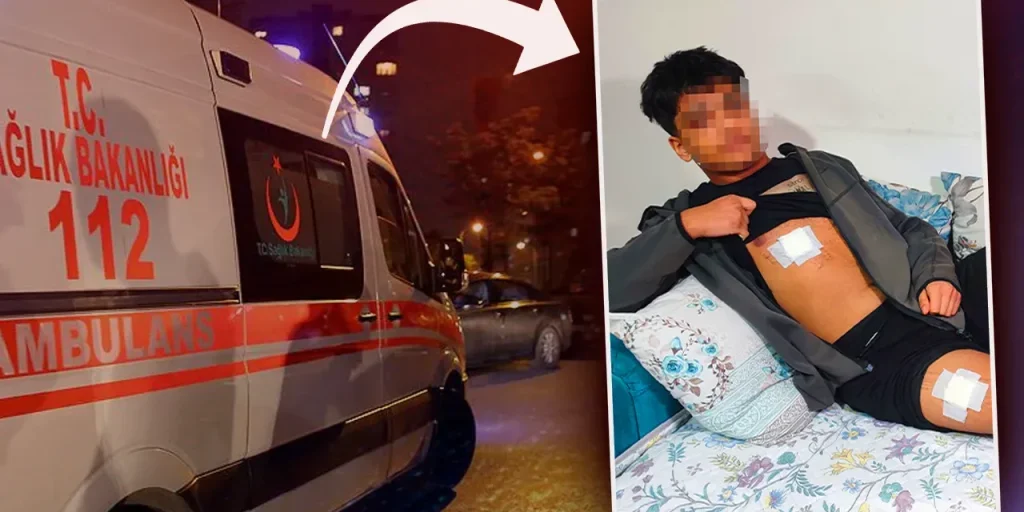 Ragazzo di 15 anni aggredito con coltelli in parco di Adana: sopravvissuto