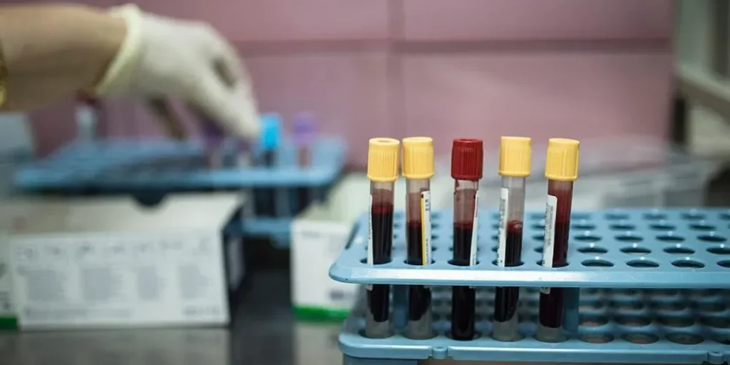 Articolo non disponibile: nessun contenuto fornito