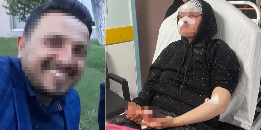 Uomo arrestato per aggressione domestica davanti al tribunale di Gaziantep