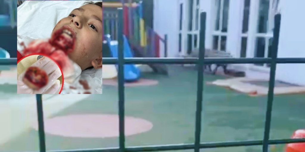 Çanakkale'de 7 yaşındaki çocuğun çenesi koptu! Ailesi hukuk mücadelesi başlattı