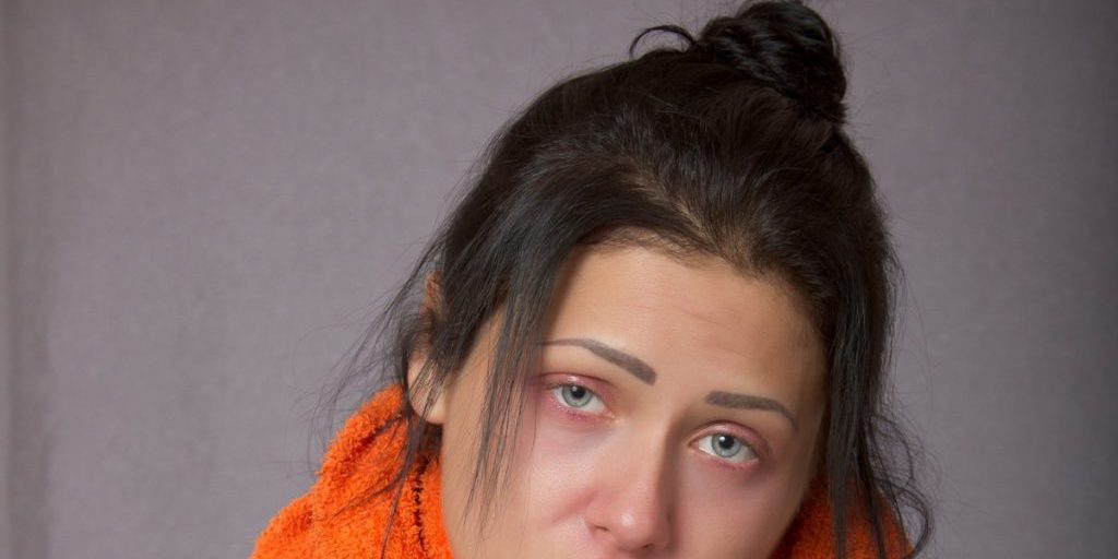 Riduzione dei casi di infezioni respiratorie virali acute nella regione di Nizhny Novgorod: una tendenza positiva per la salute pubblica