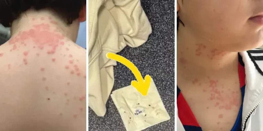 Famiglia negli Stati Uniti denuncia KLM per infestazione di insetti a bordo del volo da Virginia ad Amsterdam