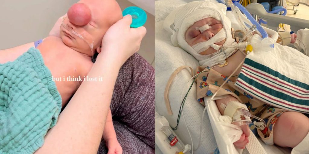 Alnında sıvı dolu balonla doğdu! Tıp tarihine geçti