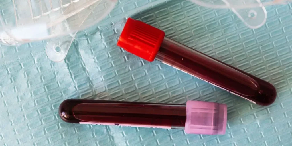 Due setti genetici in un esame del sangue: esperti avvertono di casi non rilevati