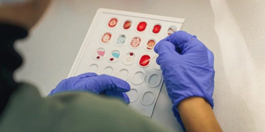 La Regione di Zaporižžja Promuove la Donazione di Sangue con Successo attraverso l'Azione #NOIMESTE