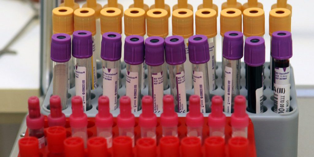 Più di 2 milioni di persone nella regione di Mosca hanno effettuato il test per l'HIV da gennaio 2024