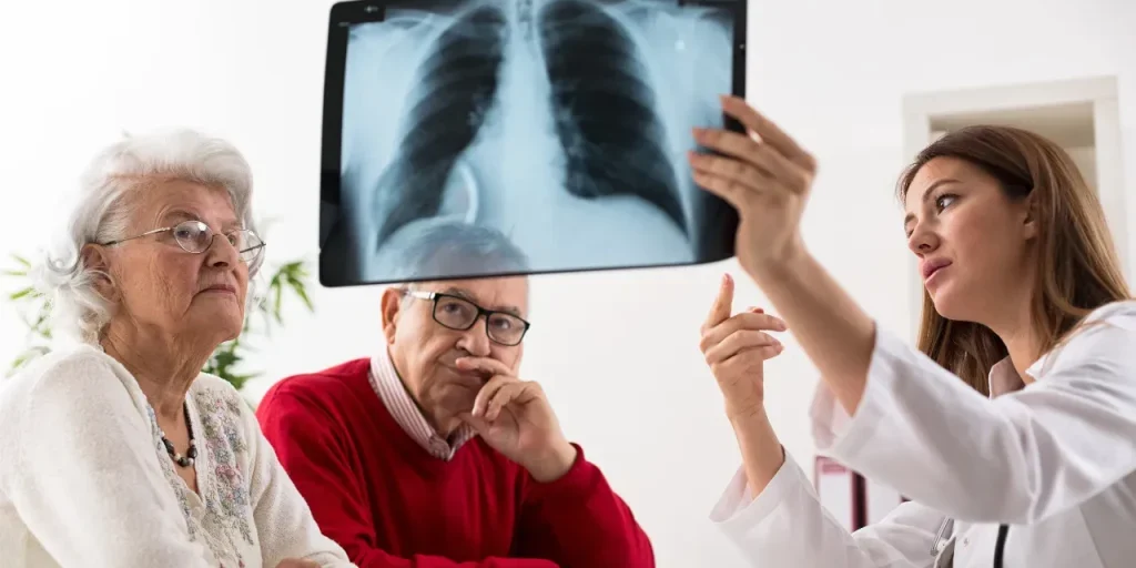 Il cancro ai polmoni può colpire anche chi non fuma