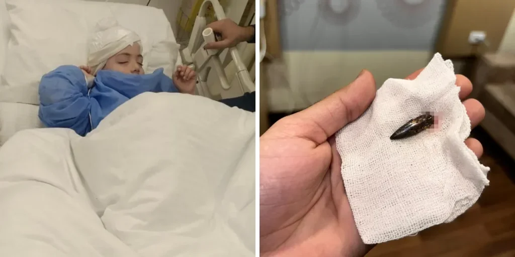 Awad, giovane di Gaza, sopravvive dopo un proiettile nella testa grazie a intervento chirurgico a Cairo con volontari turchi