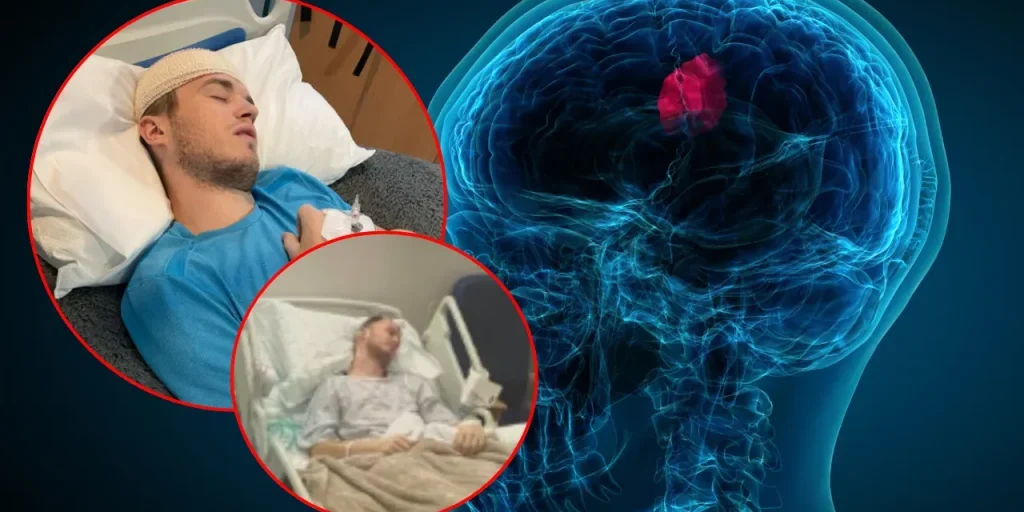Diagnosi di tumore cerebrale in giovane inglese dopo sintomi di grip