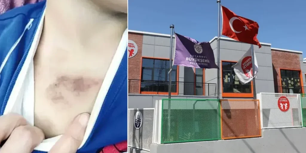 Indagine su presunti abusi su bambino in asilo di Eyüpsultan: arrestato sospetto