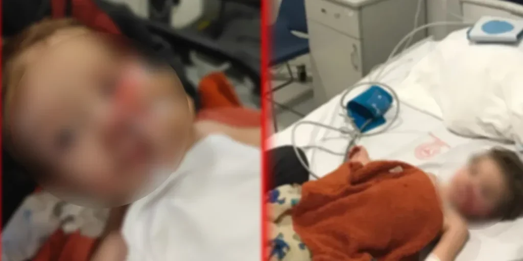 Proprietario di pitbull arrestato dopo attacco a due bambini piccoli ad Ankara