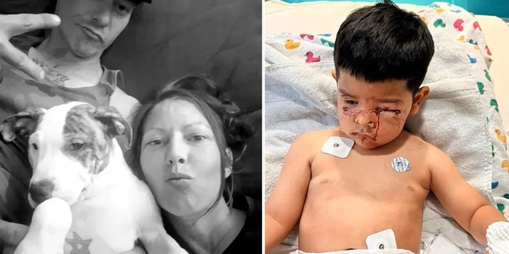 Due incidenti con cani Pitbull: una morte in Australia e un attacco a un bambino negli Stati Uniti