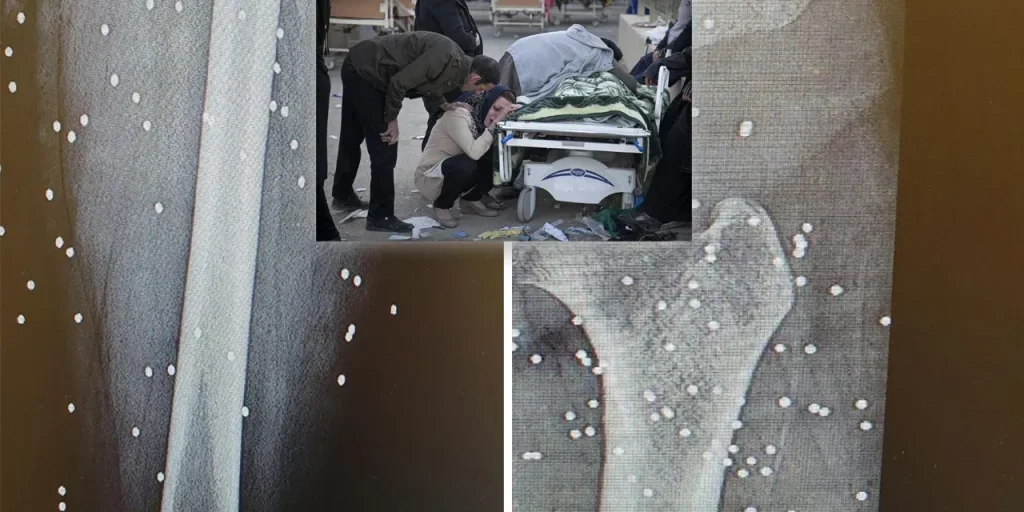 Chirurgo iraniano stima oltre 20.000 morti nelle proteste di gennaio