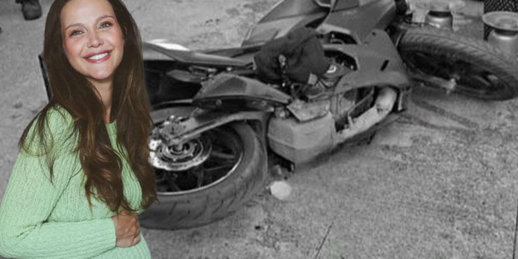 İrem Helvacıoğlu’nun başına 12 dikiş atılmıştı! İşte korkunç kazanın görüntüleri