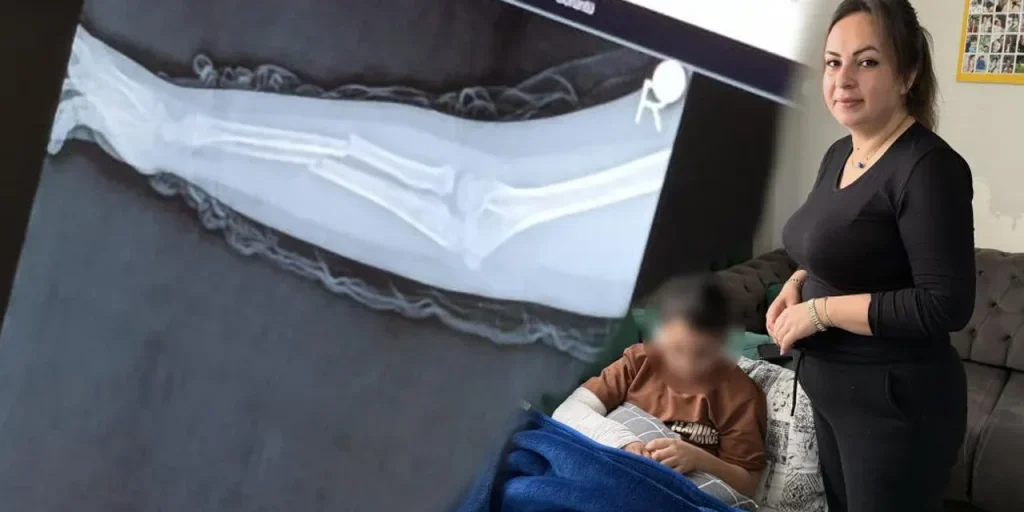 Bambino di 9 anni rompe il braccio di un compagno a scuola di Istanbul: la legge vieta procedura penale per minori sotto i 12 anni