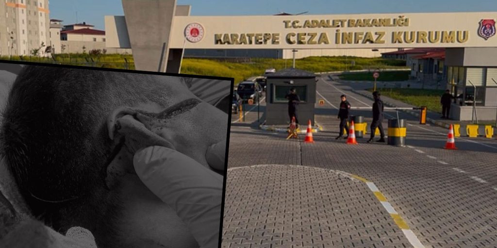 Karatepe Yüksek Güvenlikli Ceza İnfaz Kurumunda dehşet! Mahkum 3 memuru bıçakladı