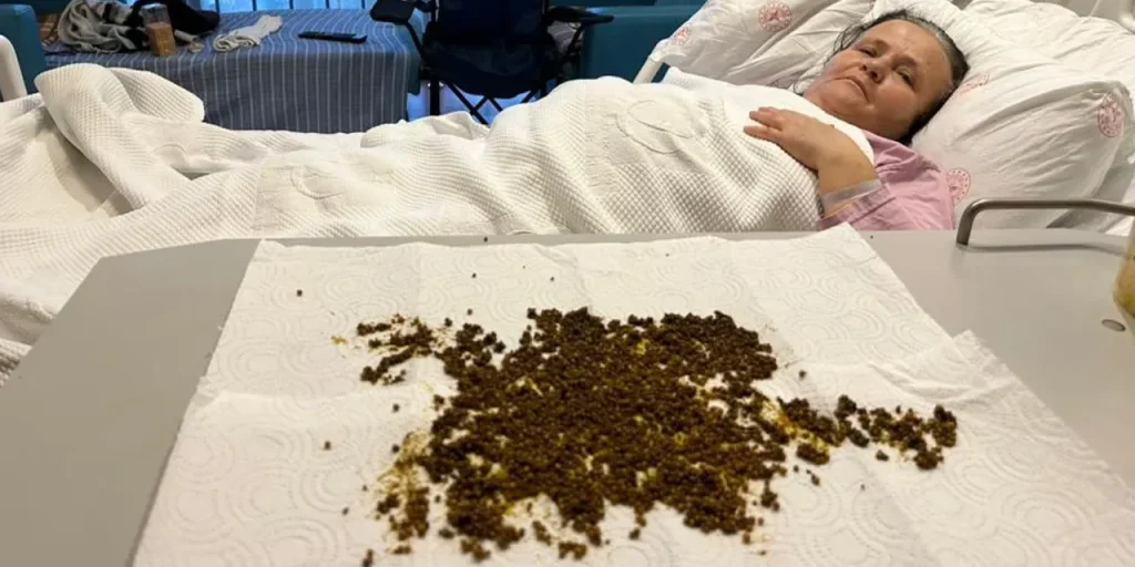 70enne Ayşe Çobanlar operata a Manisa: migliaia di calcoli biliari rimossi