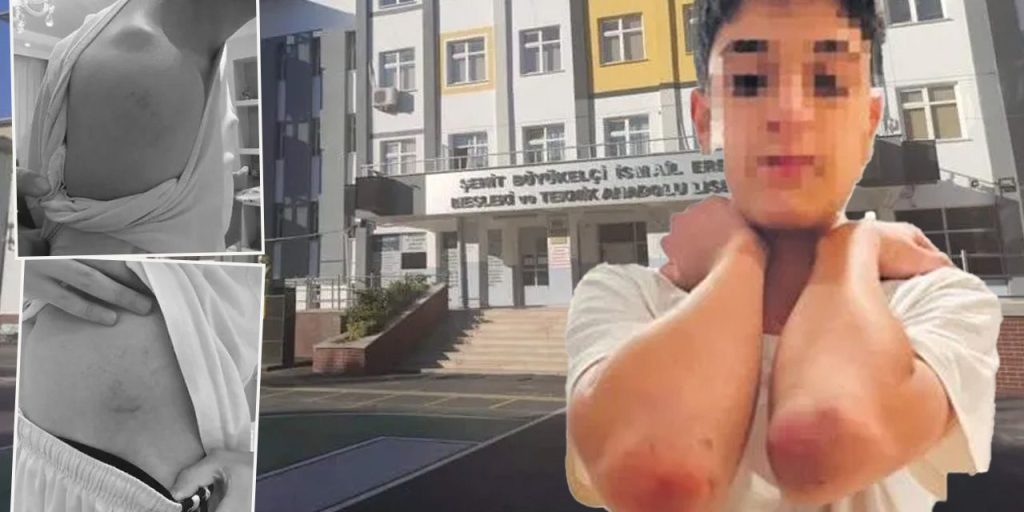 Scandalo a Istanbul: insegnante di educazione fisica impone punizione estrema agli studenti