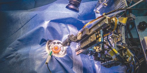 Cina sviluppa robot per iniezioni precise nella chirurgia oculare