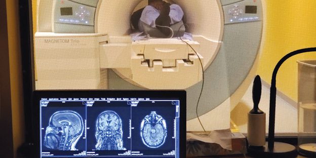 Terapia sonora non invasiva mostra effetti positivi su scimmie anziane, potenziale nuovo approccio all'Alzheimer