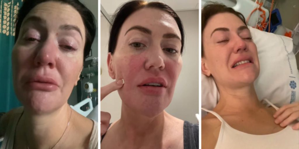 Mide ağrısını aylarca görmezden geldi, acı gerçek hastanede ortaya çıktı! "Vücudumun verdiği bir sinyalmiş"