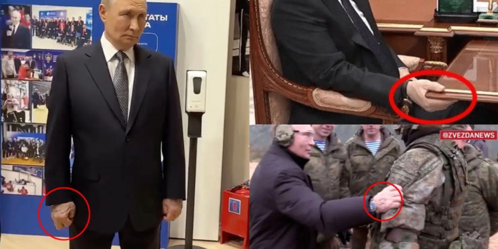 La Salute del Leader Russo: Una Preoccupazione per il Mondo Intero