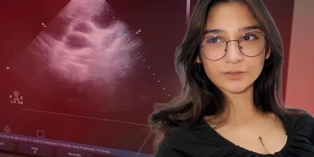 Studentessa di Izmir torna a giocare a calcio dopo intervento chirurgico per foro cardiaco di 5 cm